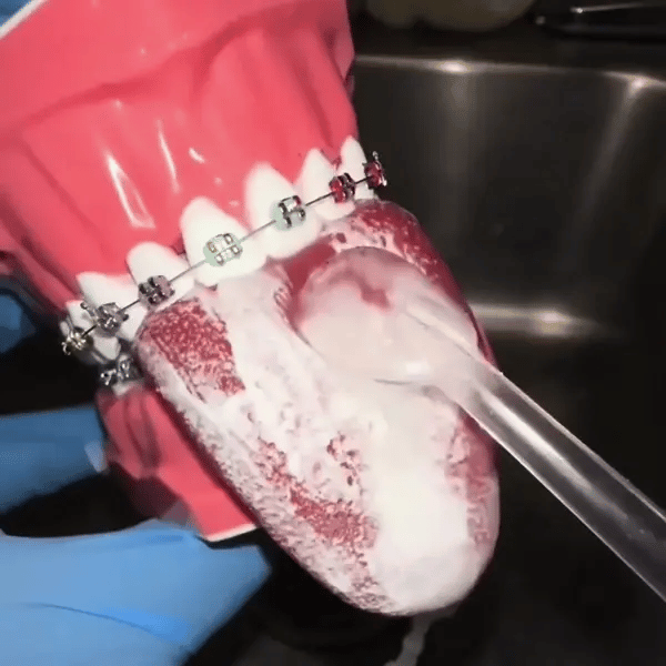 Aquapulse Munddusche