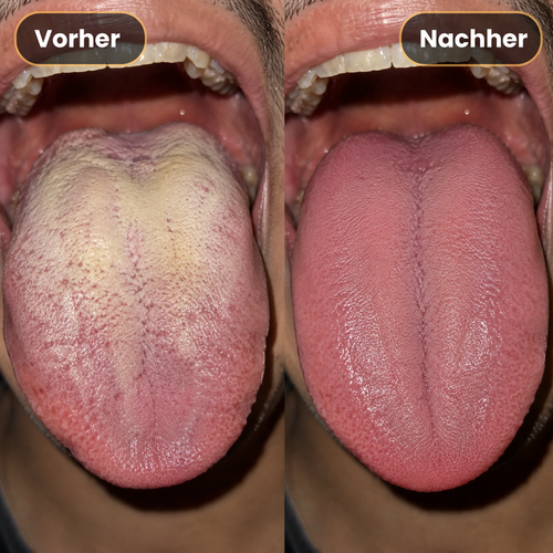 Aquapulse Munddusche